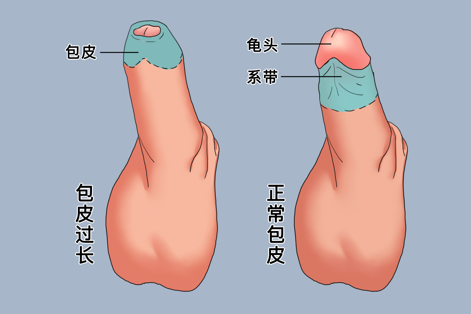 正常包皮的圖片及其相關(guān)知識(shí)科普，包皮圖片及其相關(guān)知識(shí)科普介紹