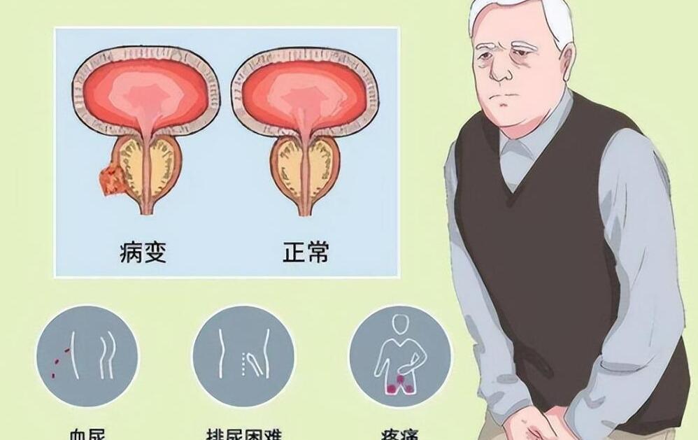 年輕人得了前列腺增大，理解、應對與關(guān)注，年輕人前列腺增大，理解、應對與關(guān)注的重要性